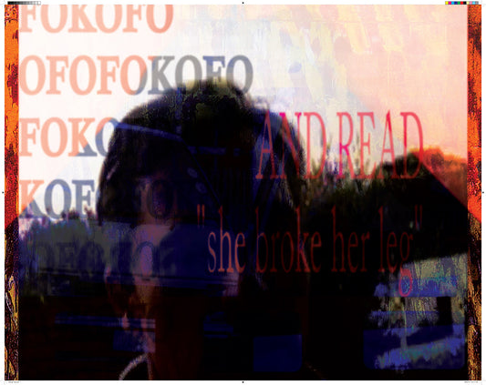 Taxi_-_Broken_Leg_7a2cf414-c4c4-4dd0-a99e-325bedc08b11